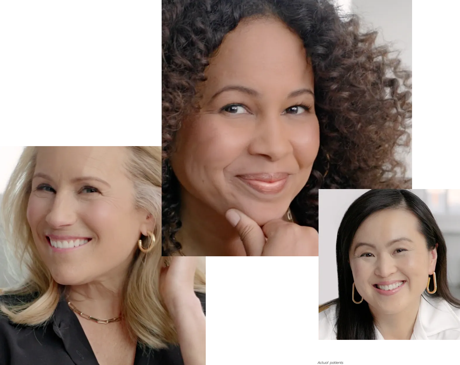 Collage of Debbie, Grace, and Erin, actual Ultherapy patients, showing non-invasive ultrasound results.