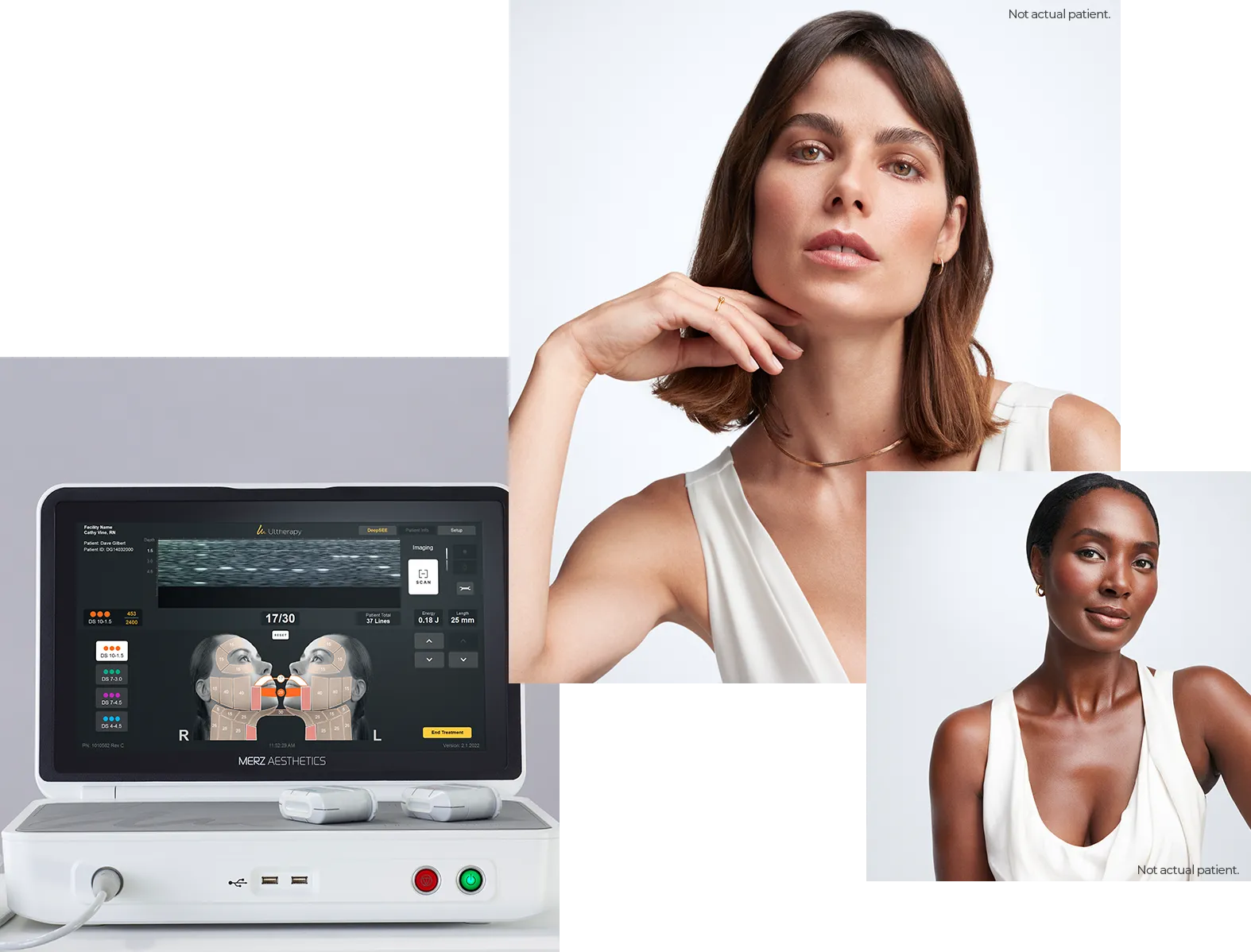 Collage featuring the Ultherapy PRIME device control unit and two women (not actual patients).