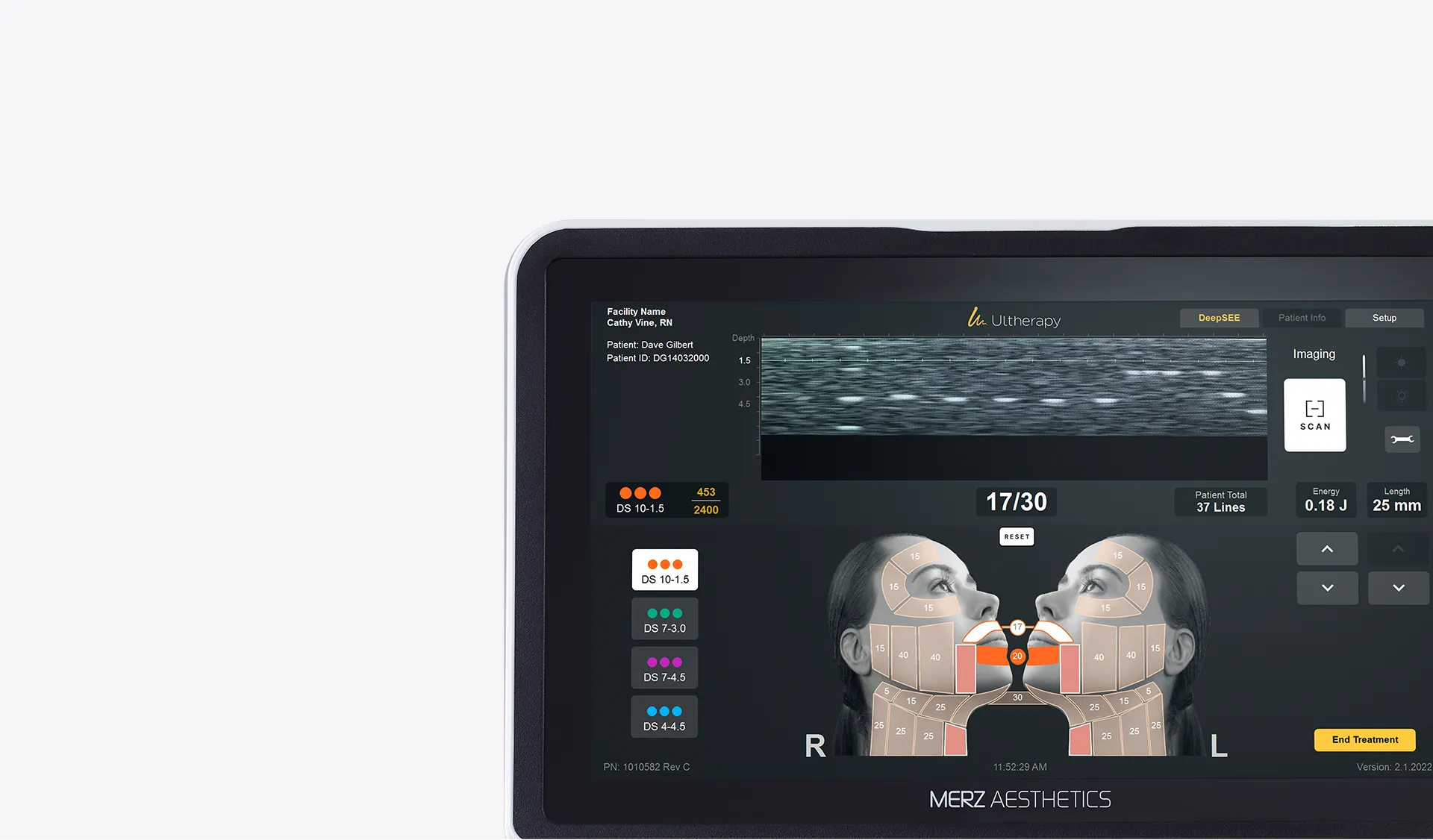 Ultherapy PRIME® device screen featuring a 35% larger display with high-resolution real-time visualization.