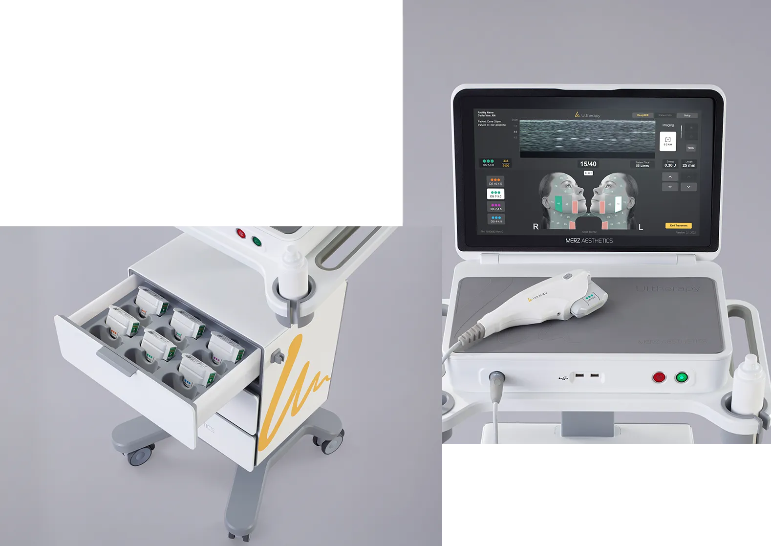 Two-part image showing Ultherapy device drawer with transducers and top portion with control unit and handpiece.