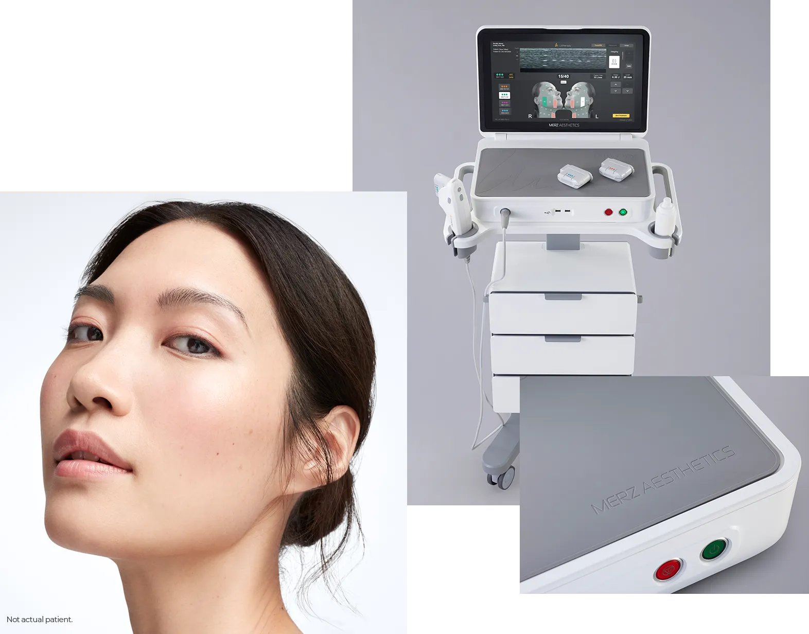 Collage of a woman’s face, the full Ultherapy PRIME® device, and a close-up of its buttons.