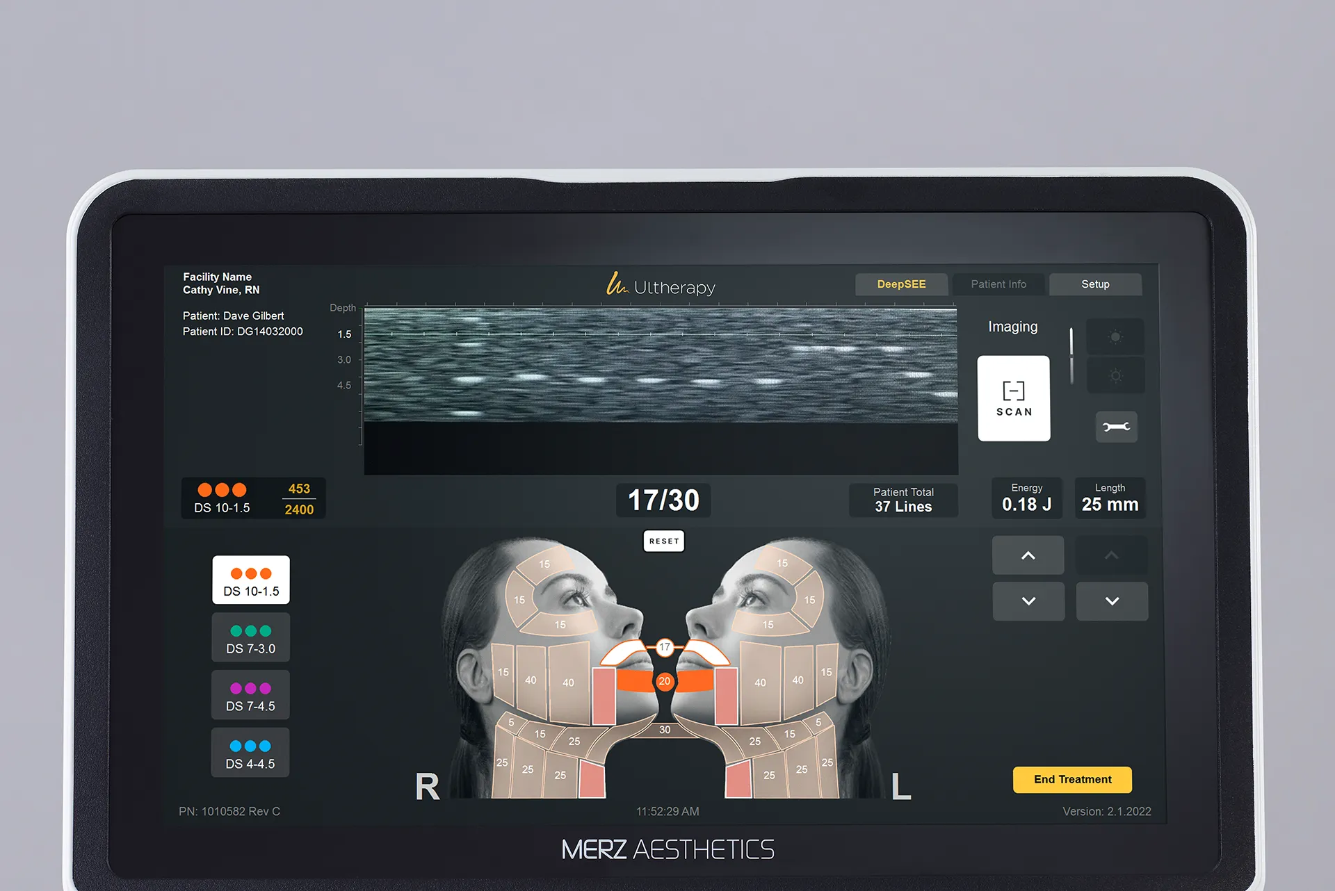 Ultherapy PRIME® monitor with vivid imaging technology for precise, personalized, and consistent treatments.