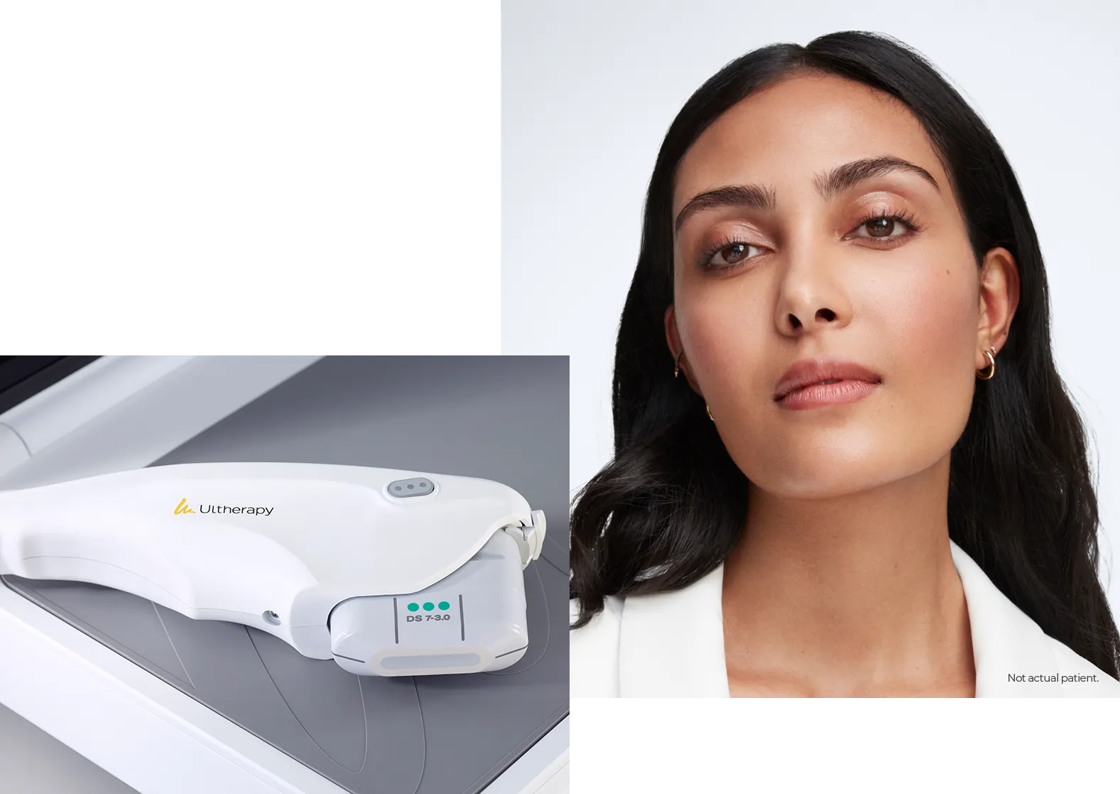 Close-up of the Ultherapy PRIME® handpiece alongside a model (not an actual patient).