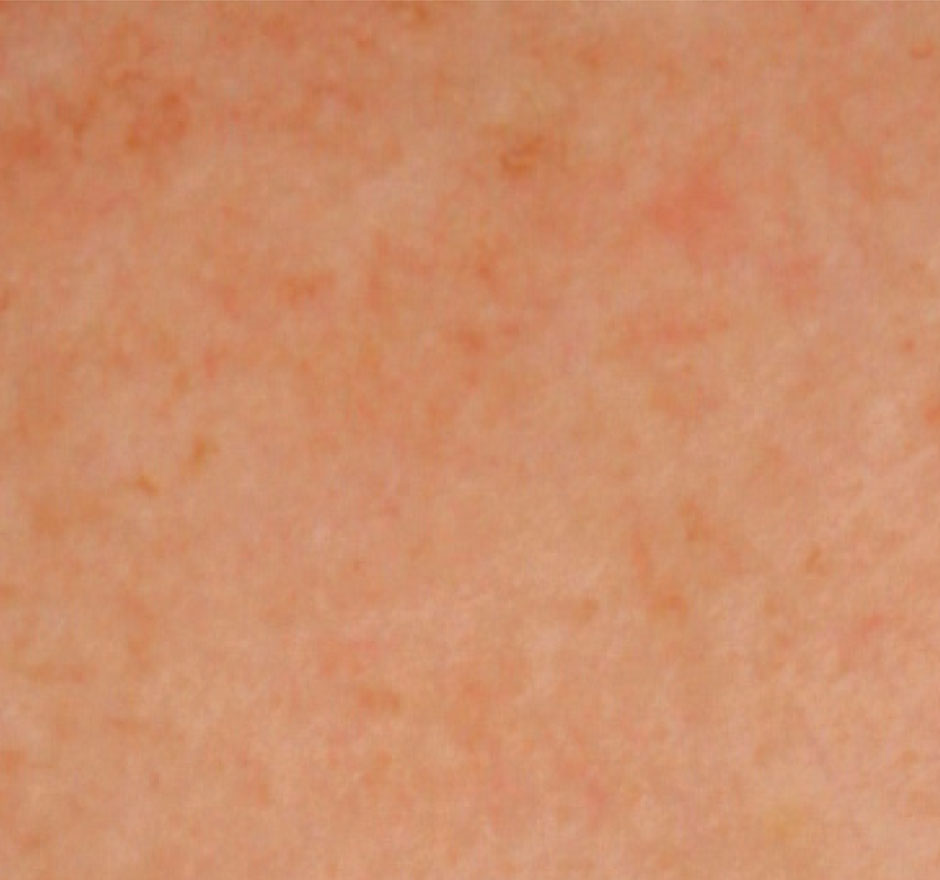 After Image