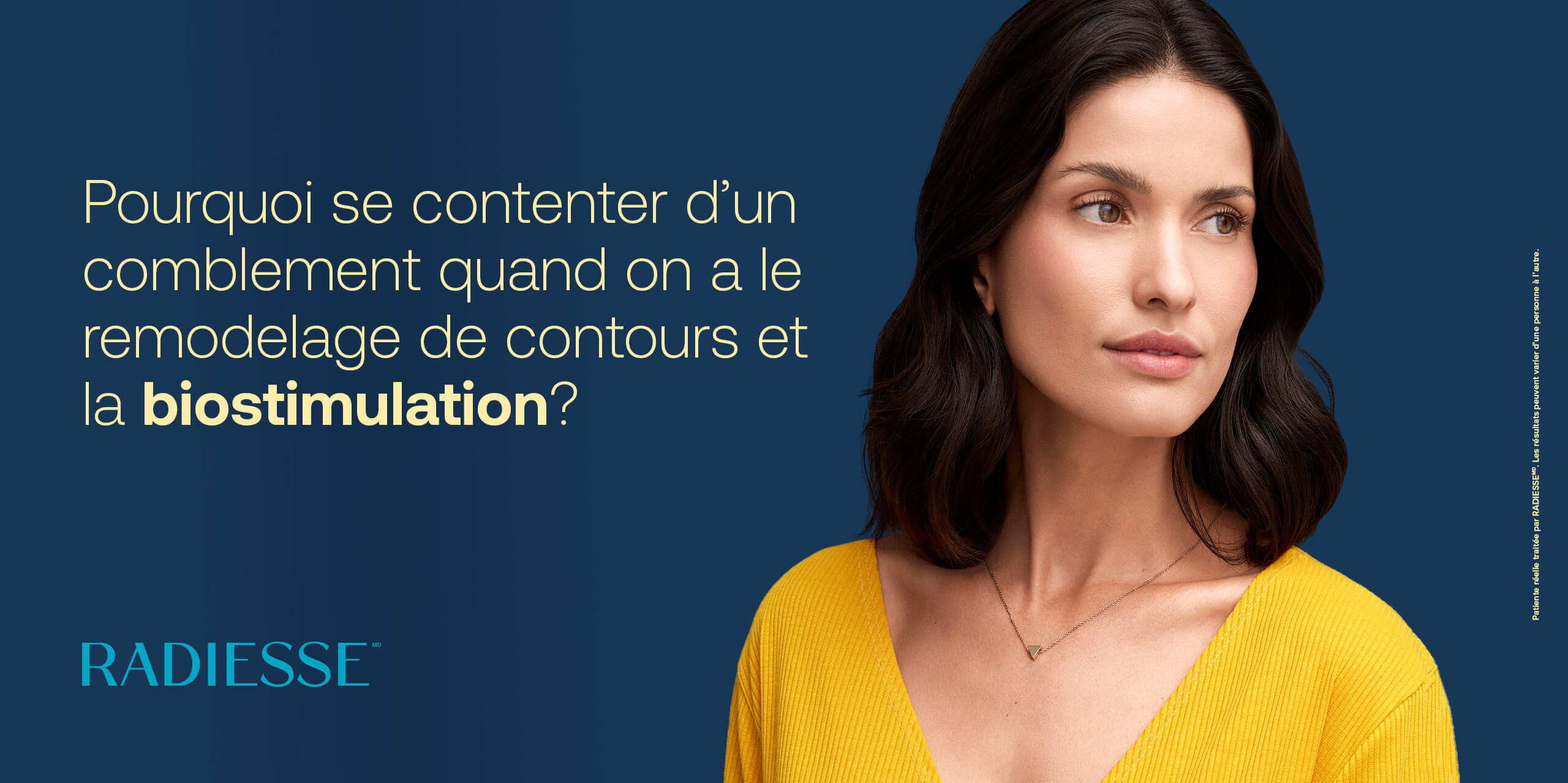 Pourquoi se contenter d’un comblement quand on a le remodelage de contours et la biostimulation?